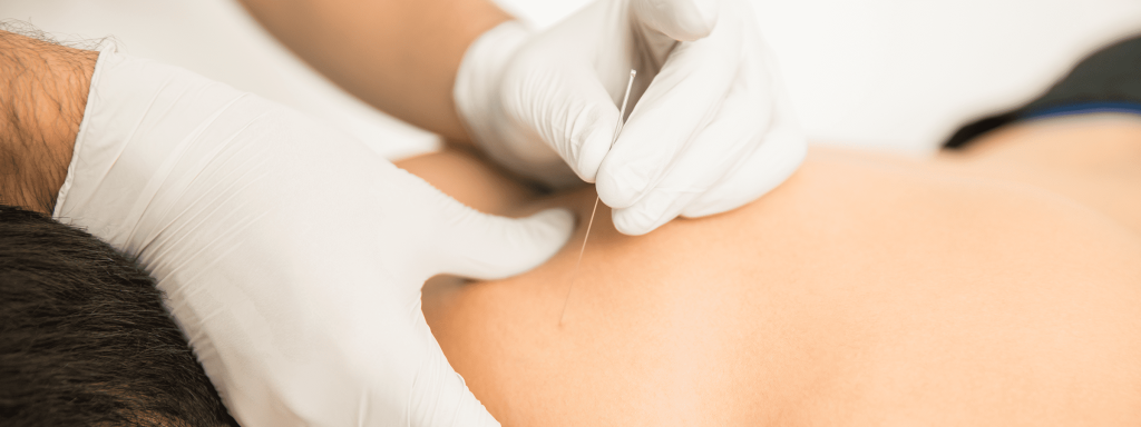 Técnicas fisioterapeuta en Málaga - Tu Fisio en Málaga